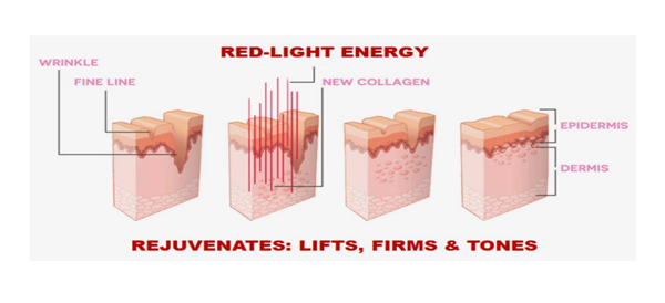 Red Light Therapy